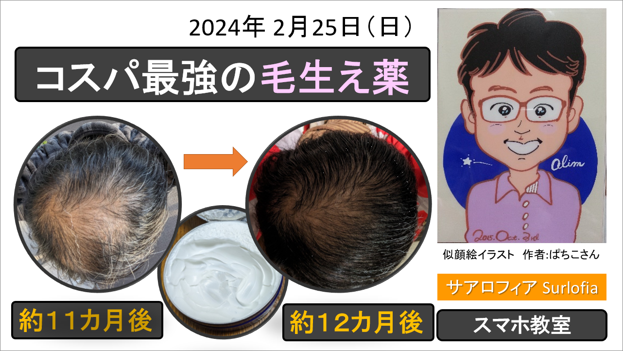 コスパ最強の毛生え薬 サアロフィア Surlofia アイキャッチ画像